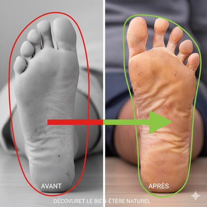 Séparateurs d’orteils silicone Alignaa – Soulagement & confort (1 paire)